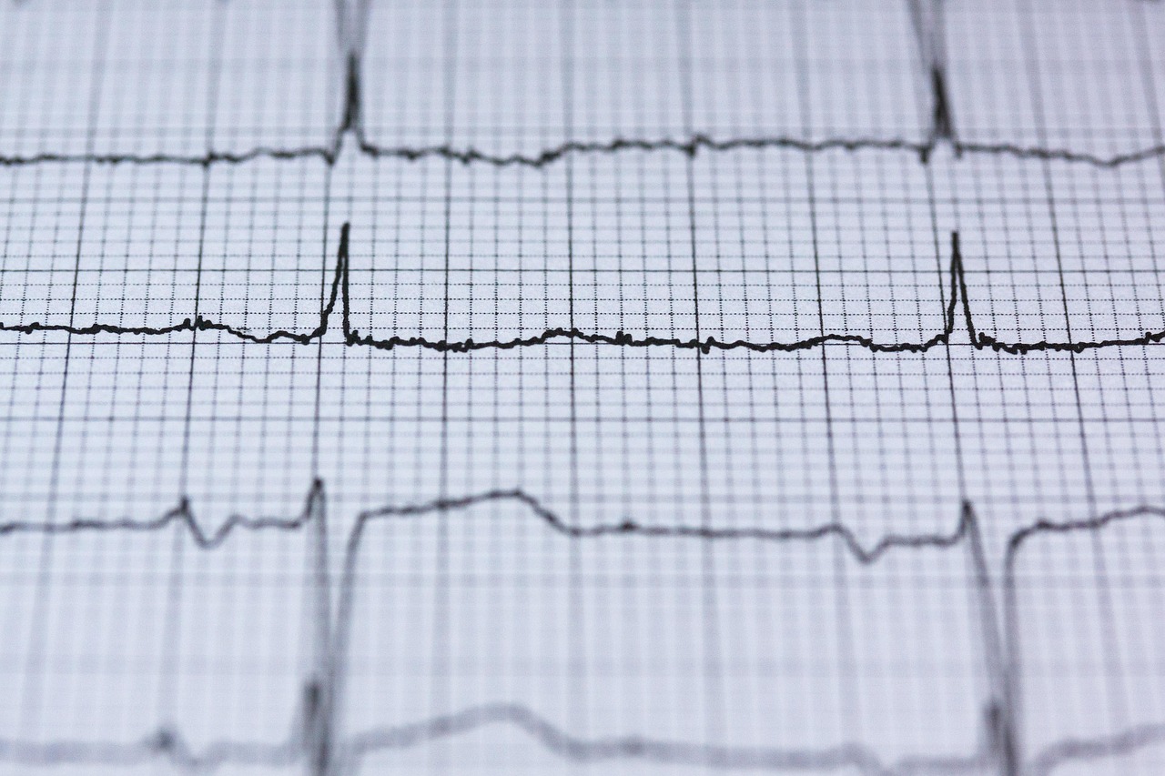 Ecg, electrocardiogram, medicine — An Overview of Cannabinoids