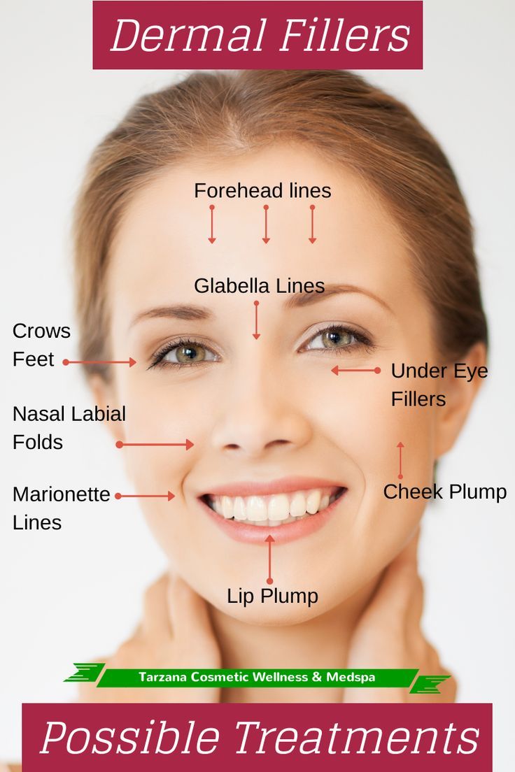 Where to locate the best facial aesthetics in Coventry